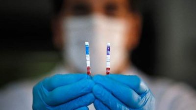 Тесты на коронавирус при госпитализации будут оплачиваться Государственной медицинской кассой