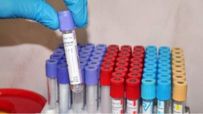 Снова выросло число новых случаев Covid-19 в Болгарии