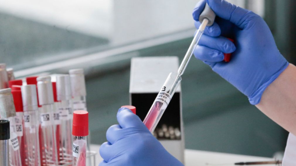 16 новых случаев коронавируса в Болгарии из исследованных 427 проб