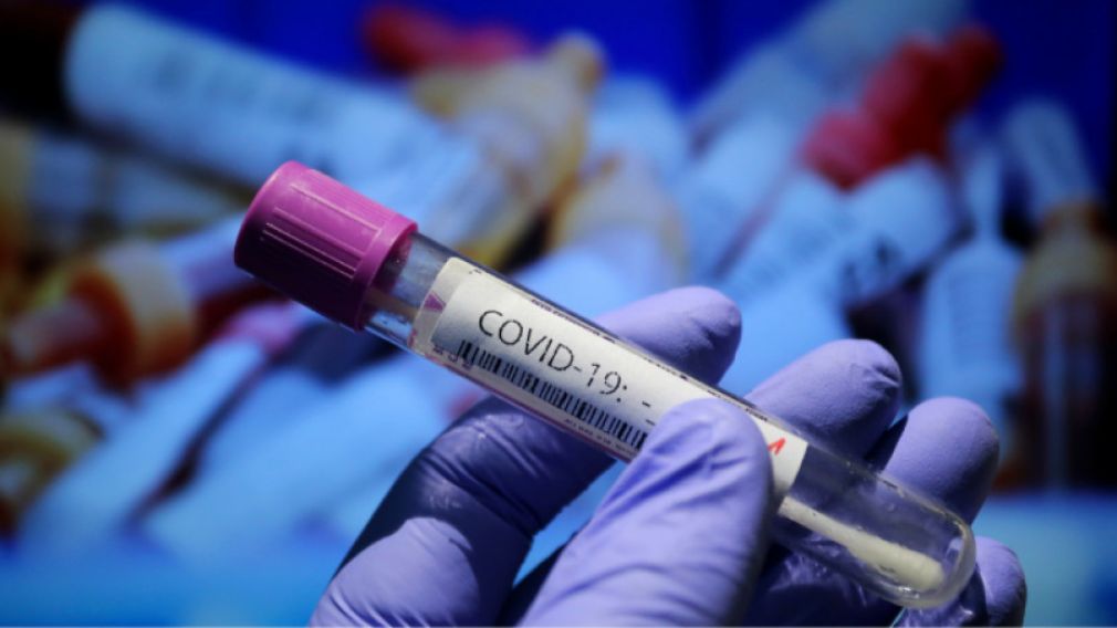 Зарегистрировано 34 новых случая заражения коронавирусом за последние 24 часа