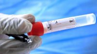 В Болгарии выявили первый случай индийского варианта коронавируса