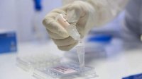3327 новых случаев коронавируса при проведенных 9179 PCR тестах​