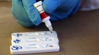9% новых случаев коронавируса при проведении 11 816 тестов